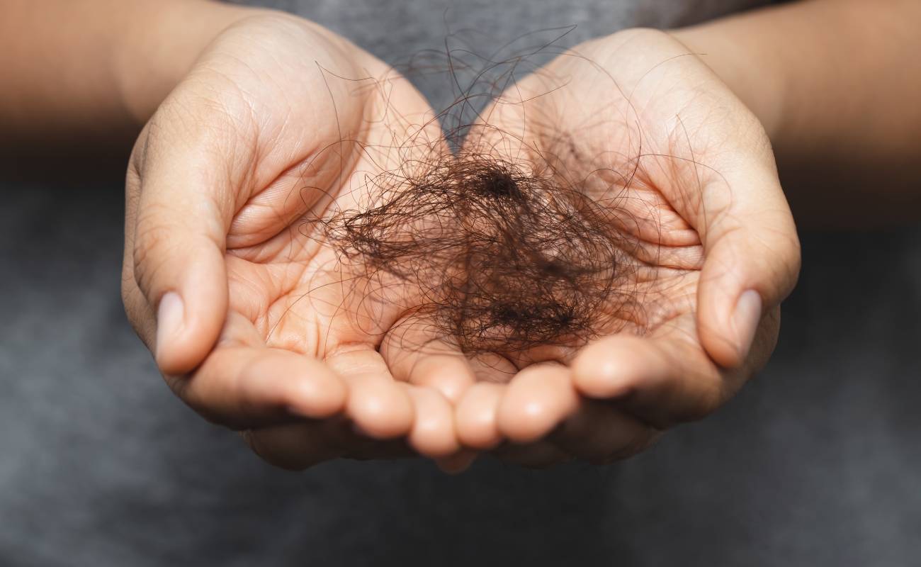 Co proti vypadávání vlasů: 28 Nejlepších Babských rad, které fungují 2 two hands gently holding shed hair to illustrate vypadávání vlasů and hair loss concerns.